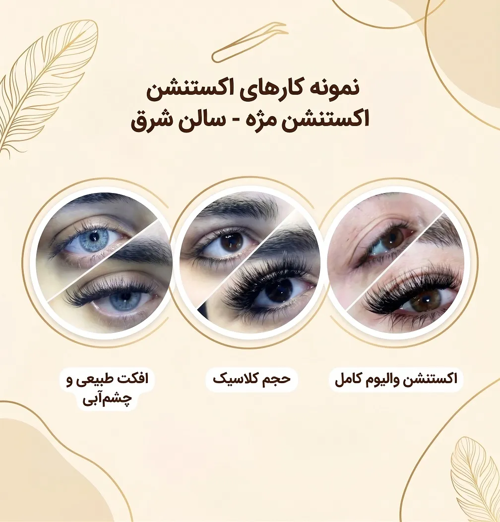 هایپر اکستنشن شرق